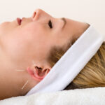 Naturheilpraxis Bonn - Elke Katharina Fischer - Heilpraktikerin - Ohrakupunktur